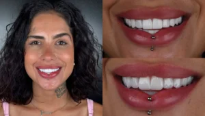 Tati Zaqui investe valor impressionante em novas lentes de contato para os dentes