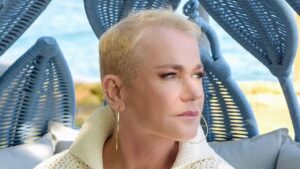 Xuxa faz implante capilar e sonha em usar penteado clássico