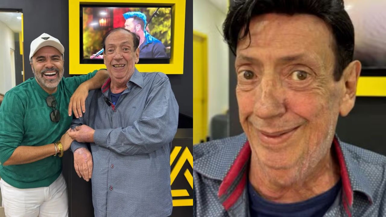 Marcos Oliveira, o Beiçola, coloca prótese e exibe o novo visual
