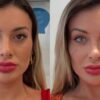 Andressa Urach faz cirurgia para mudar cor dos olhos, mas já enfrenta complicações