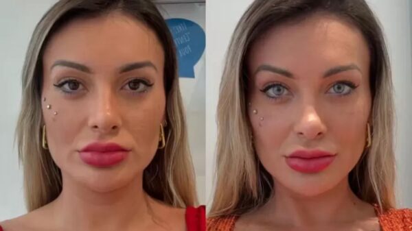 Andressa Urach faz cirurgia para mudar cor dos olhos, mas já enfrenta complicações