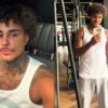 MC Livinho revela estado de saúde um mês após acidente de moto