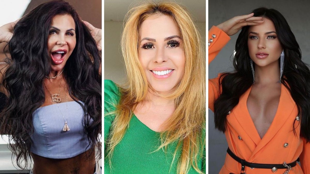 Veja o antes e depois dos famosos que fizeram harmonização facial