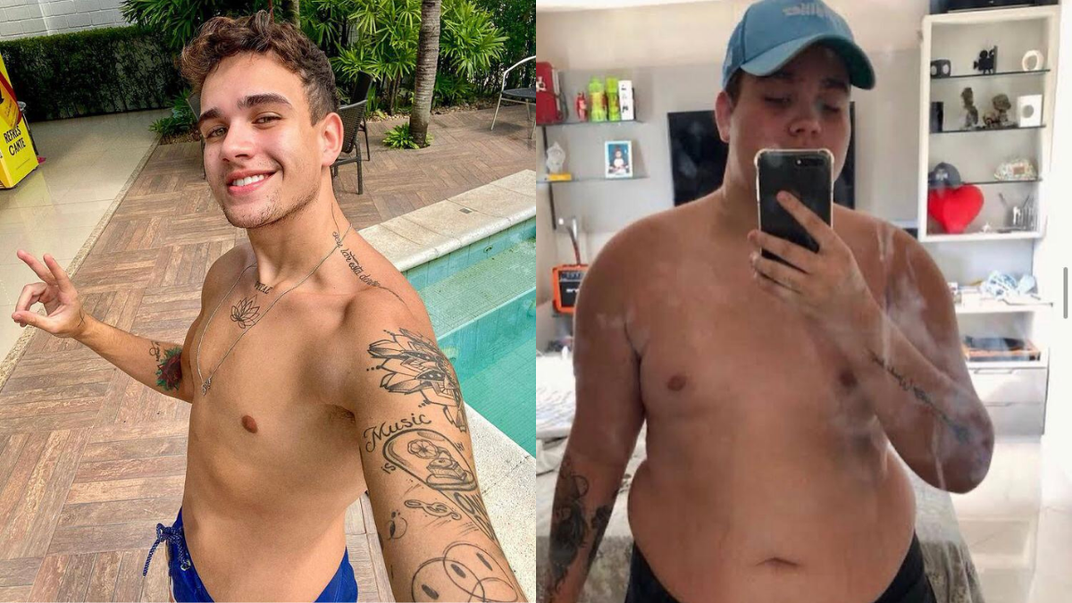 Após ser diagnosticado com obesidade mórbida, o jovem passou pela cirurgia bariátrica em 2019